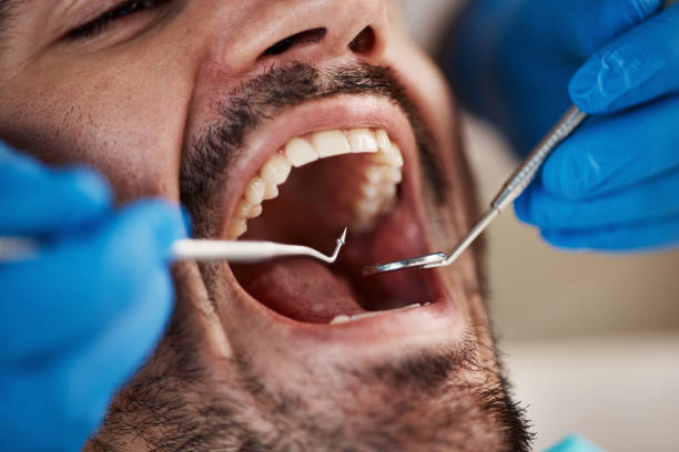 Best Weekend Emergency Dentist in Cornish, ME